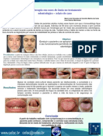 33 Fonoterapia em Casos de Ânsia No Tratamento Odontológico 2010