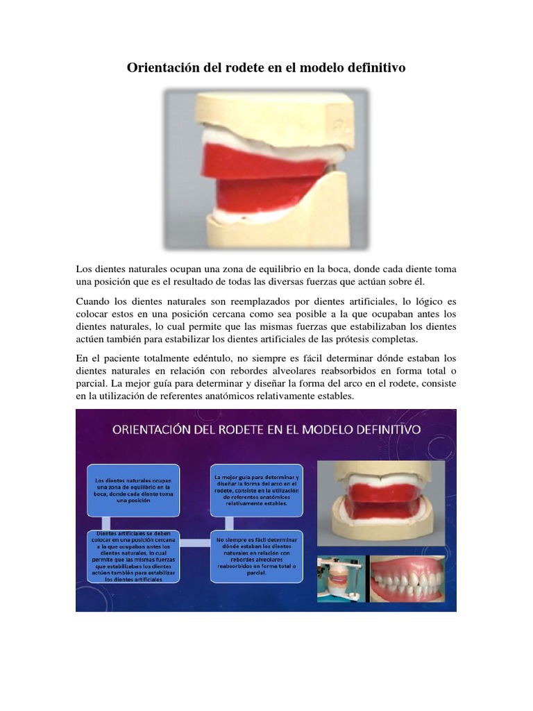Orientación Del Rodete en El Modelo Definitivo | PDF | Dentadura ...