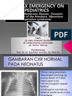 HMD VS TTN VS Mas