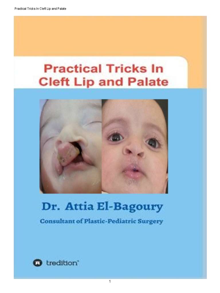 Cleft Lip and Palate Management Guide | PDF | Lip | Human Anatomy