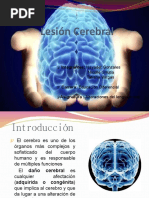 Parálisis Cerebral
