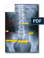 Osteo blm.doc