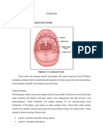 Tonsilitis