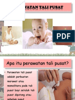 Cara Merawat Tali Pusat Bayi