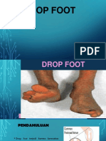 OPTIMALISASI DROP FOOT