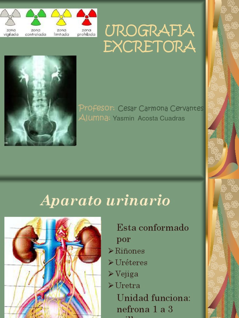 Urografia Excretora | PDF | Riñón | Sistema urinario