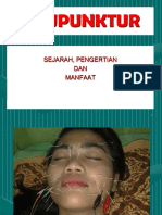 Akupunktur-Terbaru.ppt