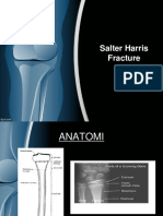 Salter Harris Fracture