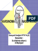 Karsinoma Nasofaring DR Damayanti S