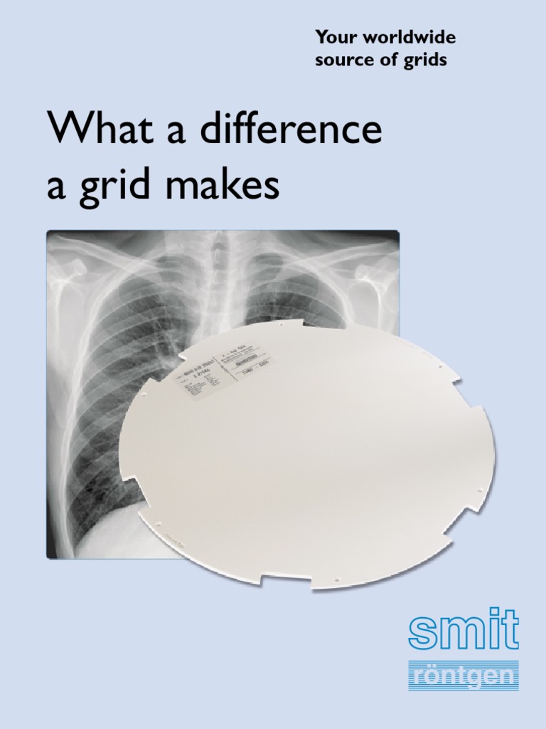 XRay Grids What A Difference A Grid Makes PDF Signal To Noise