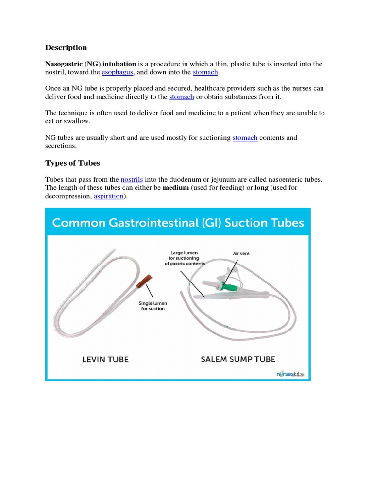 NG Tube | PDF | Medical Specialties | Medicine