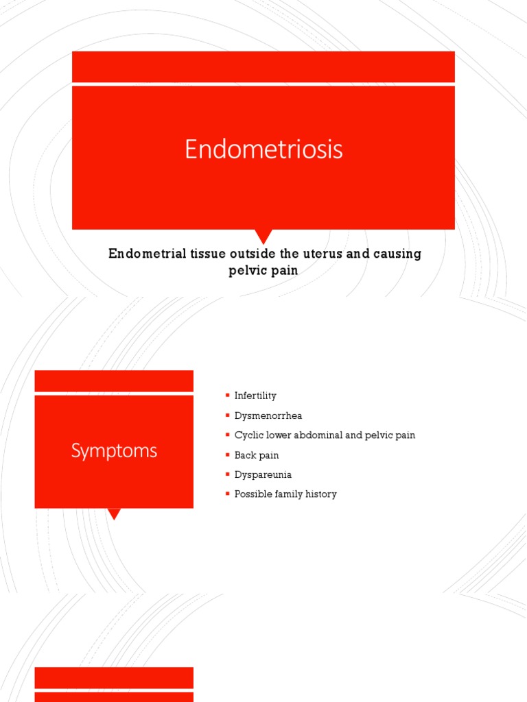 Endometriosis Endometrial Tissue Outside The Uterus And Causing Pelvic