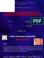 Colita Ulceroasa