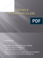 257435977-LEZIUNILE-INTERRADICULARE.pptx