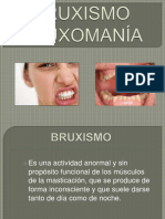 bruxismo 2sv