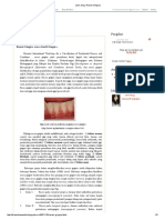 Oan's Blog - Resesi Gingiva