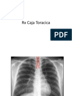 RX Caja Toracica