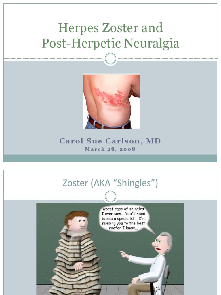 Zooster-Neuralgia Post Herpes | PDF | Analgesic | Herpes Simplex