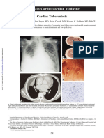 Images in Cardiovascular Medicine: Cardiac Tuberculosis
