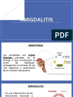 Amigdalitis