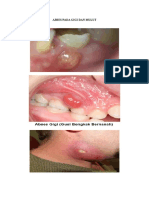 GAMBAR ABSES PADA GIGI DAN MULUT.doc