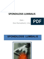 Spondilosis Lumbalis