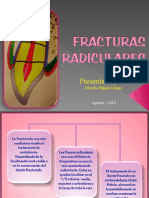 Fracturas Radiculares