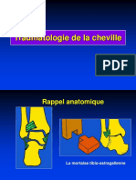 03 - Cheville Fractures