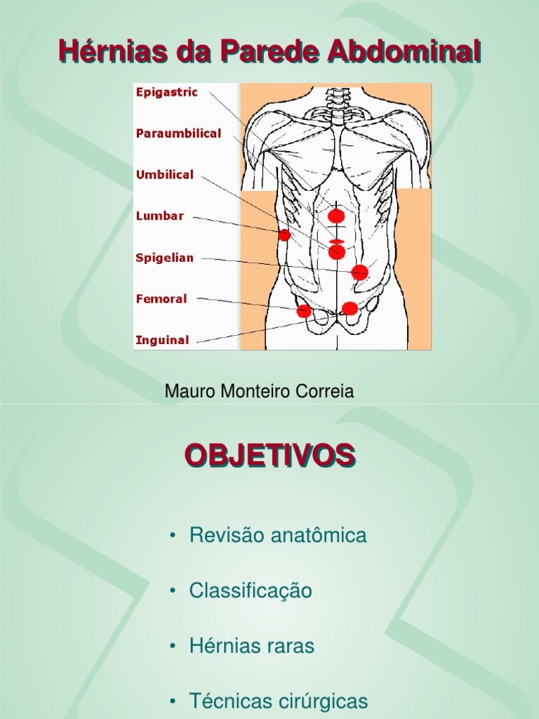 O que pode dar errado na Cirurgia de Hérnia Inguinal? • Café Cirúrgico