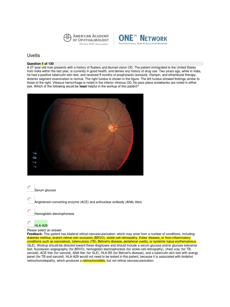 AAO Network Uveitis | PDF | Vision | Health Sciences