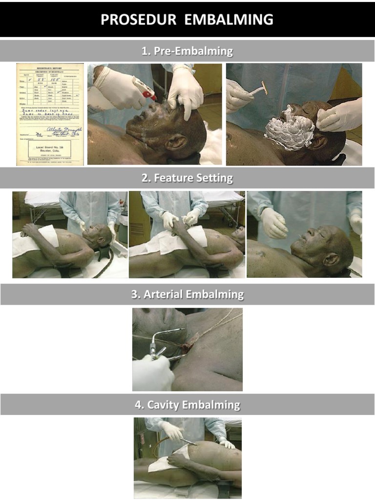 Embalming Procedures Overview | PDF