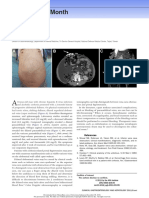 Image of The Month: Caput Medusae