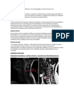 Cervicobraquialgia