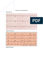 Ejercicios de Electrocardiograma Urgencia 4° Año