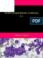 Atlas Leukemia 1