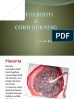 LOTUS BIRTH and Cord Burning