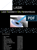 Lasik nadia