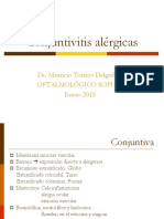 Conjuntivitis Alergica