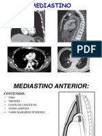 Sacha Mediastino Anterior