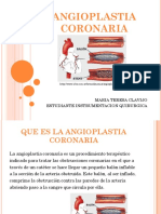 Angioplastia Coronaria
