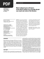 Mixed Malignant Germ Cell Tumour of The Lateral Ventricle in An 8-Month-Old Girl: Case Report and Review of The Literature