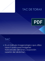 tac-torax