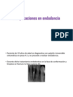 Complicaciones en Endodoncia