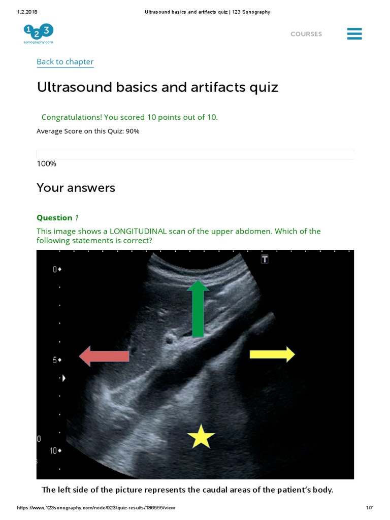 Ultrasound Basics and Artifacts Quiz 123 Sonography Sakte PDF PDF
