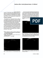 Tratamento Protético em Paciente Submetido A Glossectomia