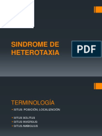 Sindrome de Heterotaxia