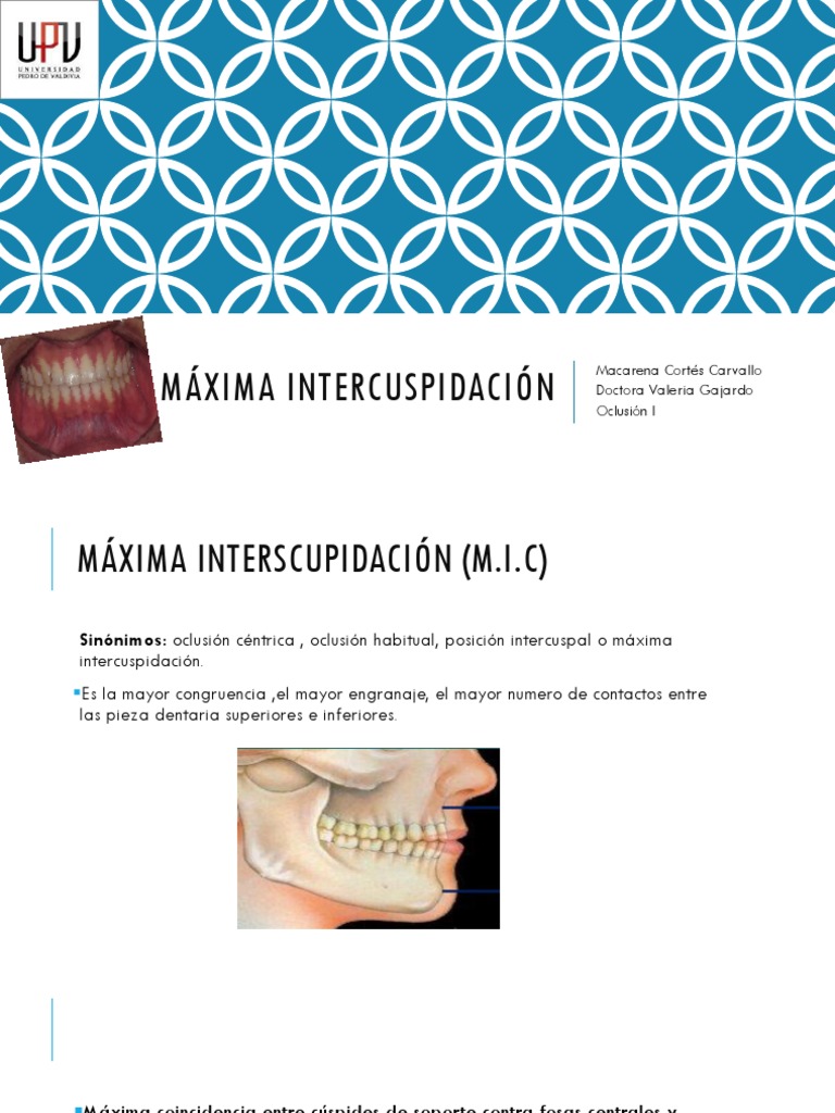 Máxima Intercuspidación | PDF