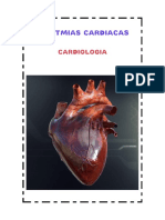 Todo Sobre Arritmias Cardiacas