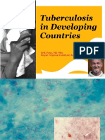 Tuberculosis in Developing Countries: Erik Post, MD MSC Royal Tropical Institute Amsterdam