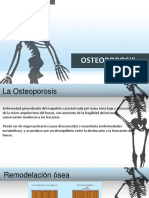 Osteoporosis Diapositivas